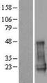 CGGBP1 Protein - Western validation with an anti-DDK antibody * L: Control HEK293 lysate R: Over-expression lysate