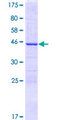 CGGBP1 Protein - 12.5% SDS-PAGE of human CGGBP1 stained with Coomassie Blue