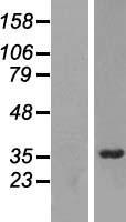 CGI-96 / RRP7A Protein - Western validation with an anti-DDK antibody * L: Control HEK293 lysate R: Over-expression lysate