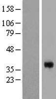 CGR19 / CGRRF1 Protein - Western validation with an anti-DDK antibody * L: Control HEK293 lysate R: Over-expression lysate