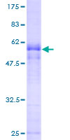 CGR19 / CGRRF1 Protein - 12.5% SDS-PAGE of human CGRRF1 stained with Coomassie Blue