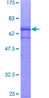 CGR19 / CGRRF1 Protein - 12.5% SDS-PAGE of human CGRRF1 stained with Coomassie Blue