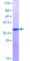 CGREF1 Protein - 12.5% SDS-PAGE Stained with Coomassie Blue.