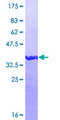 CGREF1 Protein - 12.5% SDS-PAGE Stained with Coomassie Blue.