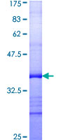 CHAF1B / CAF1 Protein - 12.5% SDS-PAGE Stained with Coomassie Blue.