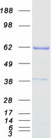 CHAF1B / CAF1 Protein - Purified recombinant protein CHAF1B was analyzed by SDS-PAGE gel and Coomassie Blue Staining