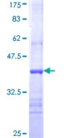 CHAT Protein - 12.5% SDS-PAGE Stained with Coomassie Blue.