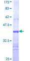 CHAT Protein - 12.5% SDS-PAGE Stained with Coomassie Blue.
