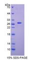CHAT Protein - Recombinant  Choline Acetyltransferase By SDS-PAGE