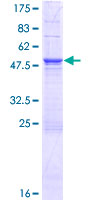 CHCHD3 Protein - 12.5% SDS-PAGE of human CHCHD3 stained with Coomassie Blue