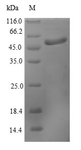 CHCHD3 Protein - (Tris-Glycine gel) Discontinuous SDS-PAGE (reduced) with 5% enrichment gel and 15% separation gel.