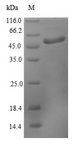 CHCHD3 Protein - (Tris-Glycine gel) Discontinuous SDS-PAGE (reduced) with 5% enrichment gel and 15% separation gel.