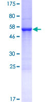 CHCHD6 Protein - 12.5% SDS-PAGE of human CHCHD6 stained with Coomassie Blue