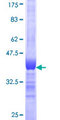 CHD1 Protein - 12.5% SDS-PAGE Stained with Coomassie Blue.