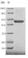 CHD1L Protein - (Tris-Glycine gel) Discontinuous SDS-PAGE (reduced) with 5% enrichment gel and 15% separation gel.