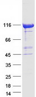 CHD1L Protein - Purified recombinant protein CHD1L was analyzed by SDS-PAGE gel and Coomassie Blue Staining