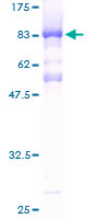 CHD2 Protein - 12.5% SDS-PAGE of human CHD2 stained with Coomassie Blue