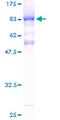 CHD2 Protein - 12.5% SDS-PAGE of human CHD2 stained with Coomassie Blue