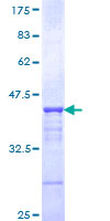 CHD3 Protein - 12.5% SDS-PAGE Stained with Coomassie Blue.
