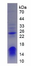 CHD3 Protein - Recombinant Chromodomain Helicase DNA Binding Protein 3 By SDS-PAGE