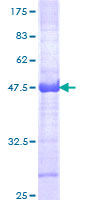 CHD4 Protein - 12.5% SDS-PAGE Stained with Coomassie Blue.