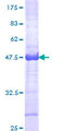 CHD4 Protein - 12.5% SDS-PAGE Stained with Coomassie Blue.