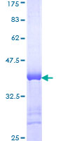 CHD8 Protein - 12.5% SDS-PAGE Stained with Coomassie Blue.