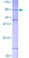 CHEK1 / CHK1 Protein - 12.5% SDS-PAGE of human CHEK1 stained with Coomassie Blue