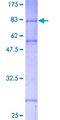 CHEK1 / CHK1 Protein - 12.5% SDS-PAGE of human CHEK1 stained with Coomassie Blue