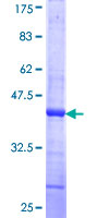 CHEK1 / CHK1 Protein - 12.5% SDS-PAGE Stained with Coomassie Blue.