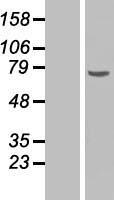 CHEK2 / CHK2 Protein - Western validation with an anti-DDK antibody * L: Control HEK293 lysate R: Over-expression lysate