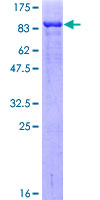 CHEK2 / CHK2 Protein - 12.5% SDS-PAGE of human CHEK2 stained with Coomassie Blue
