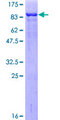 CHEK2 / CHK2 Protein - 12.5% SDS-PAGE of human CHEK2 stained with Coomassie Blue