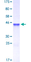 CHEK2 / CHK2 Protein - 12.5% SDS-PAGE Stained with Coomassie Blue.