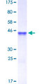 CHEK2 / CHK2 Protein - 12.5% SDS-PAGE Stained with Coomassie Blue.