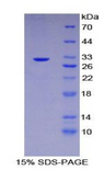 CHEK2 / CHK2 Protein - Recombinant Checkpoint Homolog 2 By SDS-PAGE