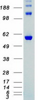 CHEK2 / CHK2 Protein - Purified recombinant protein CHEK2 was analyzed by SDS-PAGE gel and Coomassie Blue Staining