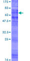 CHEMR23 / CMKLR1 Protein - 12.5% SDS-PAGE of human CMKLR1 stained with Coomassie Blue