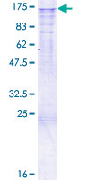 CHERP Protein - 12.5% SDS-PAGE of human CHERP stained with Coomassie Blue