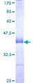 CHERP Protein - 12.5% SDS-PAGE Stained with Coomassie Blue