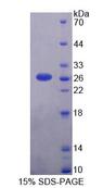 CHERP Protein - Recombinant Calcium Homeostasis Endoplasmic Reticulum Protein (CHERP) by SDS-PAGE