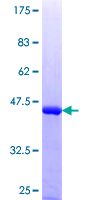 CHF1 / HEY2 Protein - 12.5% SDS-PAGE Stained with Coomassie Blue.