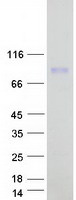 CHFR Protein - Purified recombinant protein CHFR was analyzed by SDS-PAGE gel and Coomassie Blue Staining