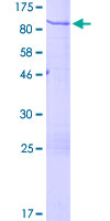 CHGA / Chromogranin A Protein - 12.5% SDS-PAGE of human CHGA stained with Coomassie Blue