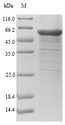 CHI3L1 / YKL-40 Protein - (Tris-Glycine gel) Discontinuous SDS-PAGE (reduced) with 5% enrichment gel and 15% separation gel.
