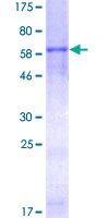 CHI3L1 / YKL-40 Protein - 12.5% SDS-PAGE of human CHI3L1 stained with Coomassie Blue