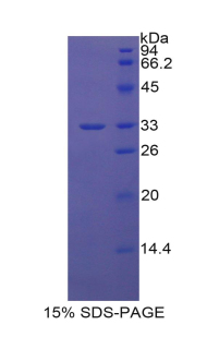 CHI3L1 / YKL-40 Protein