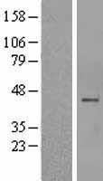 CHIA / Amcase Protein - Western validation with an anti-DDK antibody * L: Control HEK293 lysate R: Over-expression lysate