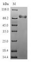 CHIA / Amcase Protein - (Tris-Glycine gel) Discontinuous SDS-PAGE (reduced) with 5% enrichment gel and 15% separation gel.