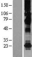 CHIC2 Protein - Western validation with an anti-DDK antibody * L: Control HEK293 lysate R: Over-expression lysate